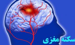 برای اولین بار در کشور / سکته‌های مغزی در کرمانشاه «از راه دور»درمان می‌شود