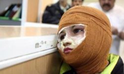 مصدومان چهارشنبه آخر سال در کرمانشاه