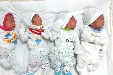 تولد نوزاد چهار قلو در کرمانشاه