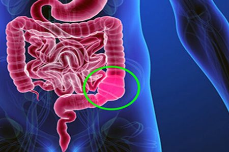 “یبوست” چیست و چگونه درمان می‌شود