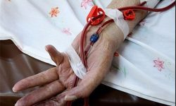 بیمار هموفیلی در استان کرمانشاه وجود دارد