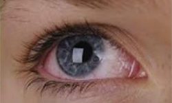 تمام مبتلایان به دیابت باید مرتب معاینه چشم انجام دهند
