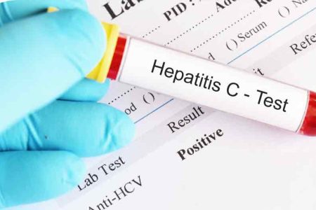 کرمانشاه پایلوت حذف هپاتیت C شد